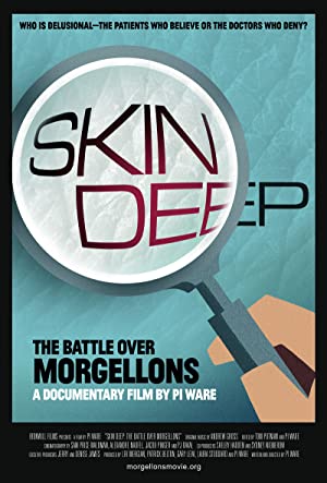 Skin Deep: The Battle Over Morgellons (2019) Free Movie